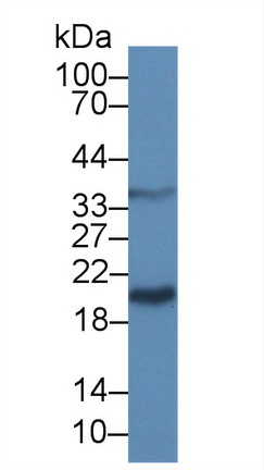 半乳糖凝集素9(GAL9)多克隆抗體