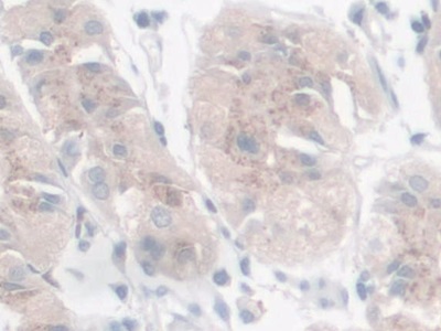 半乳糖凝集素9(GAL9)多克隆抗体