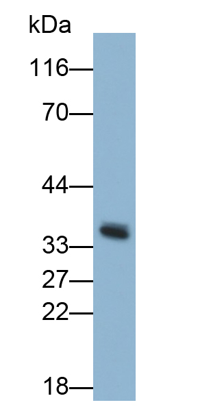 半乳糖凝集素9(GAL9)多克隆抗体