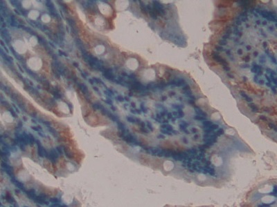 半乳糖凝集素9(GAL9)多克隆抗體
