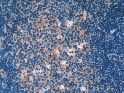 半乳糖凝集素9(GAL9)多克隆抗體