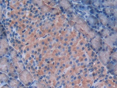 半乳糖凝集素9(GAL9)多克隆抗體