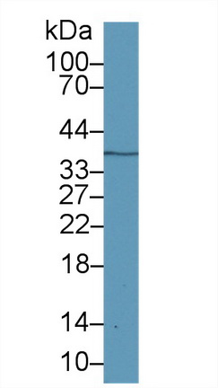 半乳糖凝集素12(GAL12)多克隆抗體