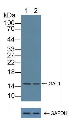 半乳糖凝集素1(GAL1)多克隆抗体