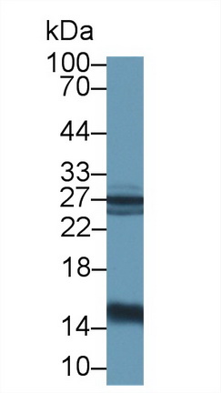 半乳糖凝集素1(GAL1)多克隆抗体