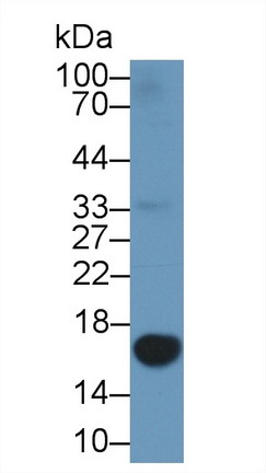 半乳糖凝集素1(GAL1)多克隆抗体
