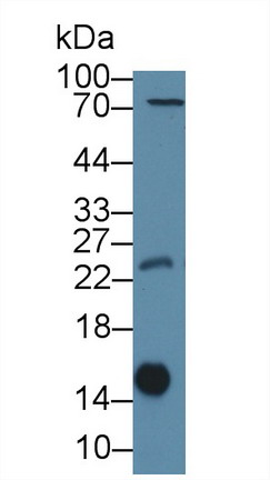半乳糖凝集素1(GAL1)多克隆抗体
