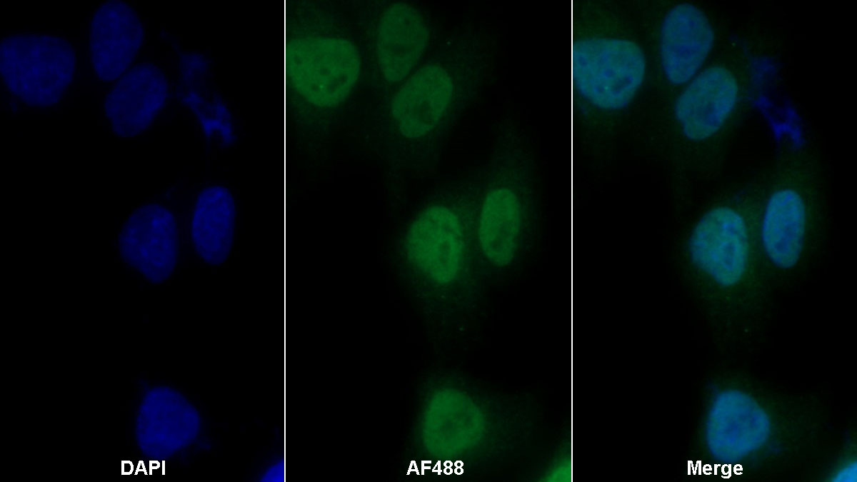 不均一核糖核蛋白A2/B1(HNRPA2B1)多克隆抗体