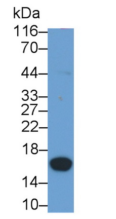 蛋白激酶抑制因子β(PKIb)多克隆抗体