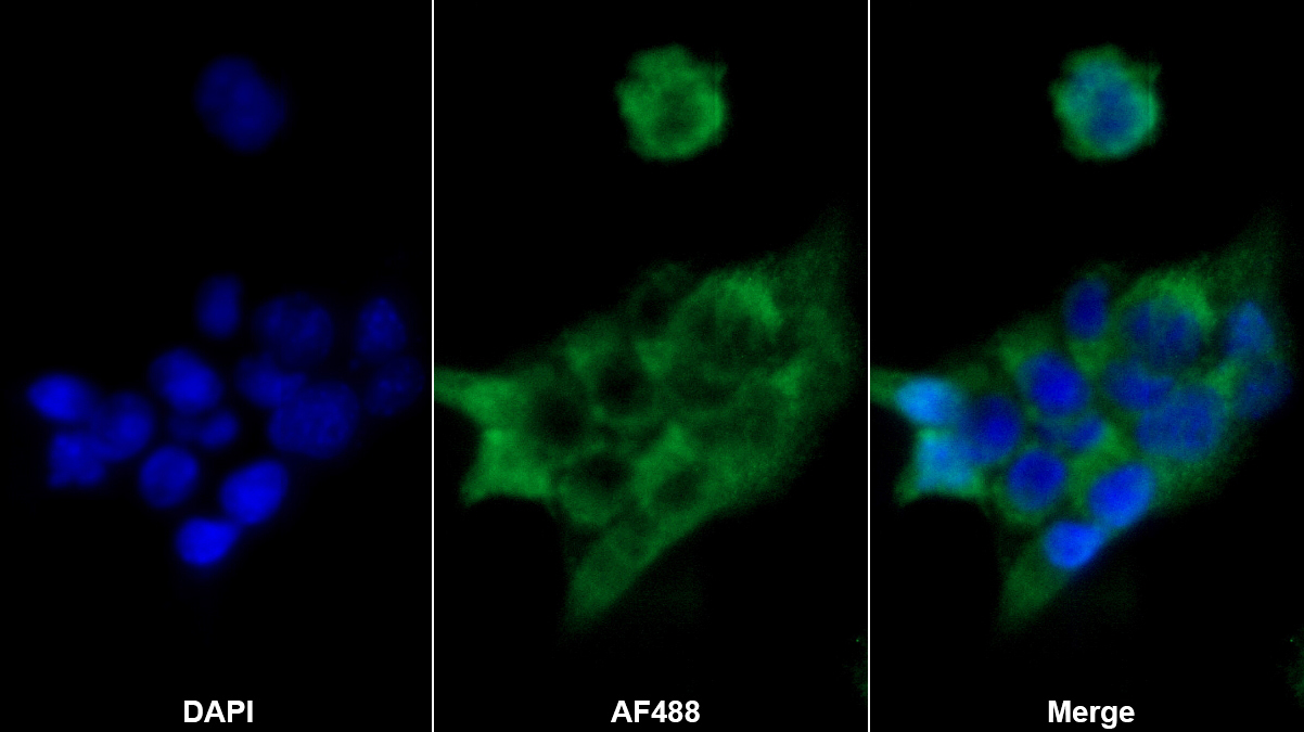線粒體?；d體蛋白(ACP)多克隆抗體