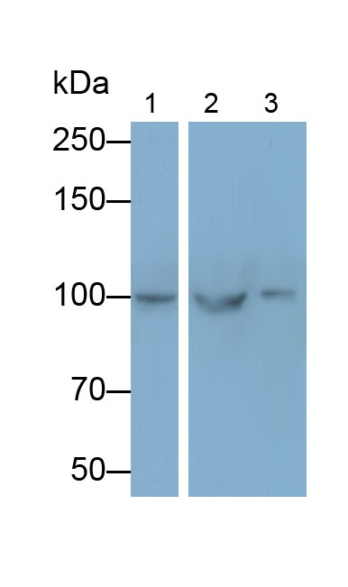 輔肌動(dòng)蛋白α2(ACTN2)多克隆抗體