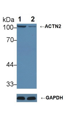 輔肌動(dòng)蛋白α2(ACTN2)多克隆抗體
