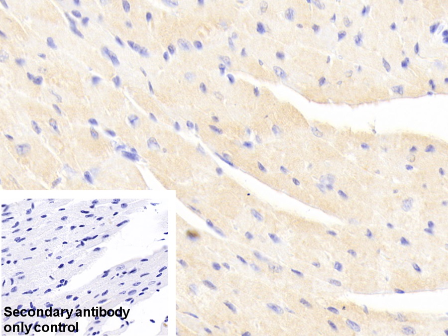 輔肌動(dòng)蛋白α2(ACTN2)多克隆抗體