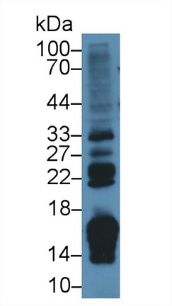 视黄醇结合蛋白2(RBP2)多克隆抗体