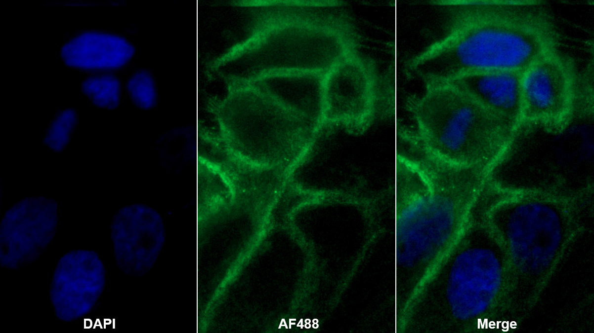 膽囊收縮素4(CCK4)多克隆抗體
