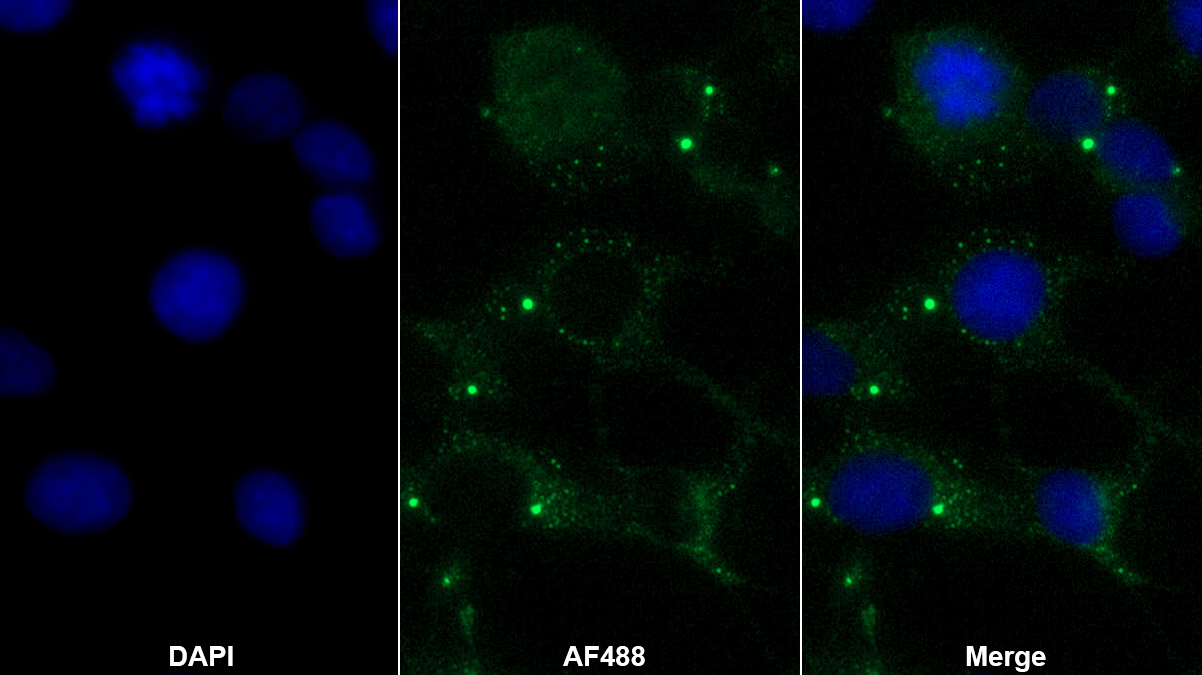 血管活性肠肽(VIP)多克隆抗体