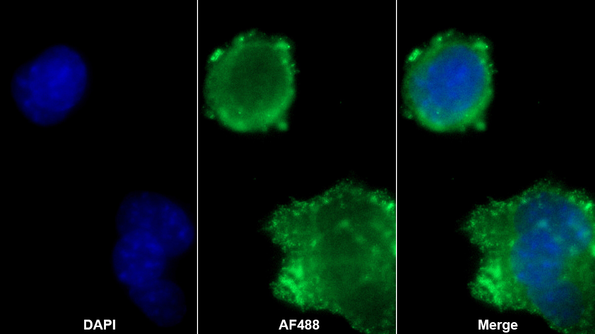蛋白激酶抑制因子γ(PKIg)多克隆抗体