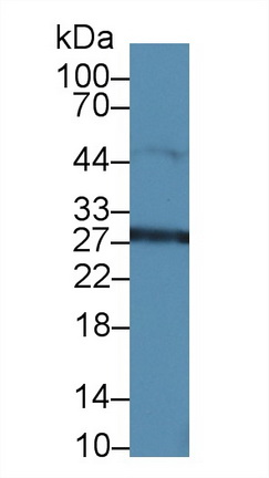 高遷移率族蛋白1(HMGB1)多克隆抗體
