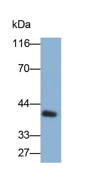 基質(zhì)金屬蛋白酶12(MMP12)多克隆抗體