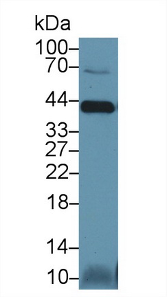 胱天蛋白酶14(CASP14)多克隆抗体