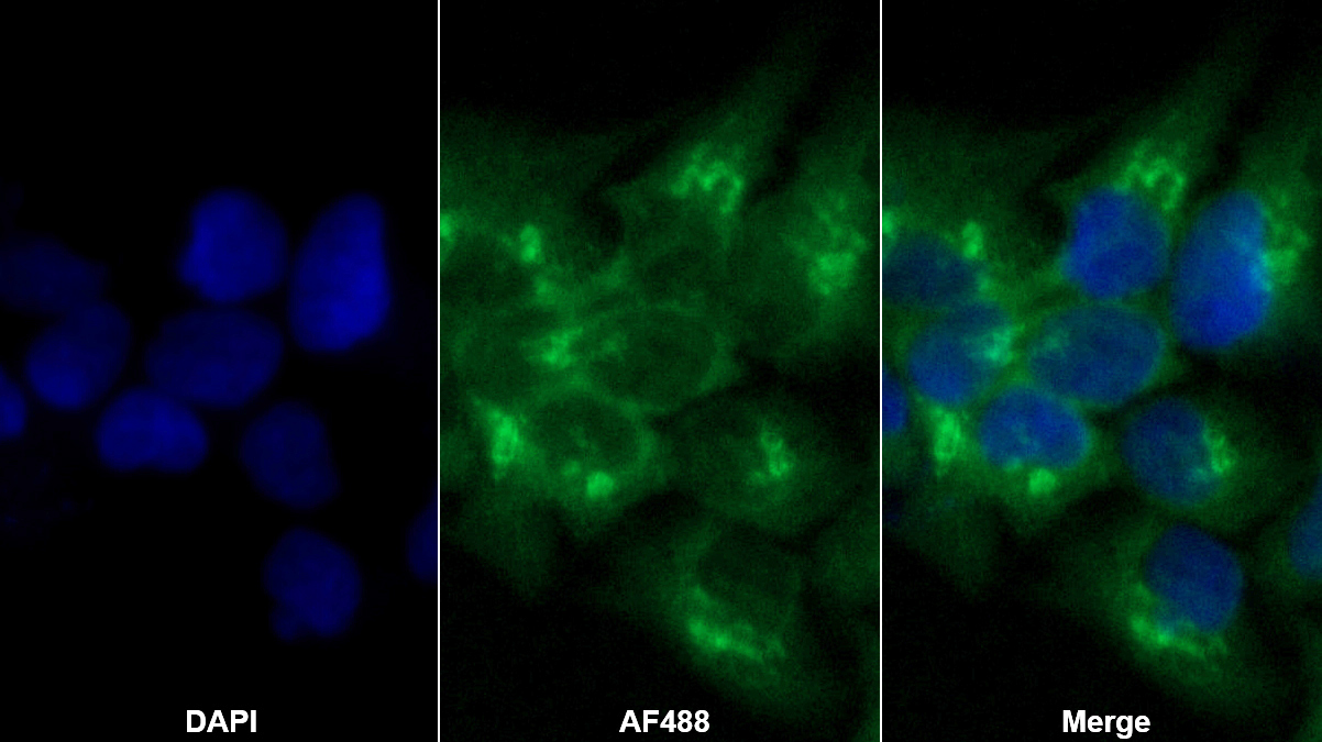 胱天蛋白酶14(CASP14)多克隆抗體