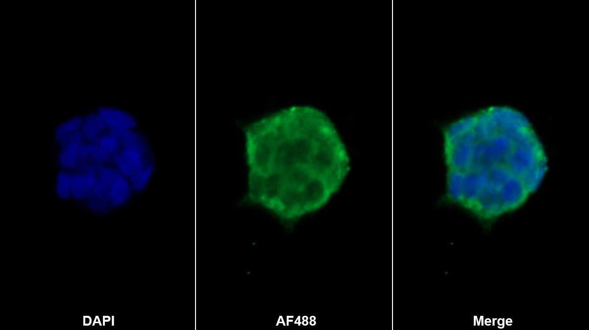 內(nèi)皮脂肪酶(LIPG)多克隆抗體