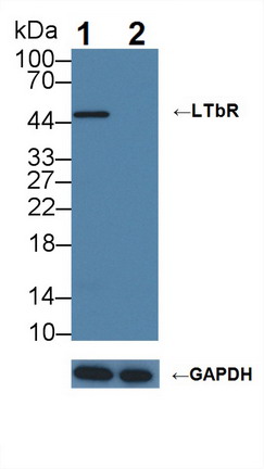 淋巴毒素β受體(LTbR)多克隆抗體