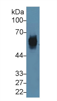 角蛋白5(CK5)多克隆抗體