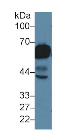 角蛋白5(CK5)多克隆抗體