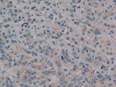 蛋白激酶D1(PKD1)多克隆抗体
