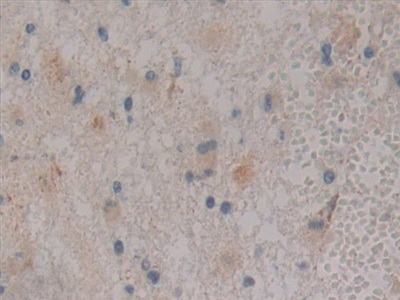 蛋白激酶D1(PKD1)多克隆抗体