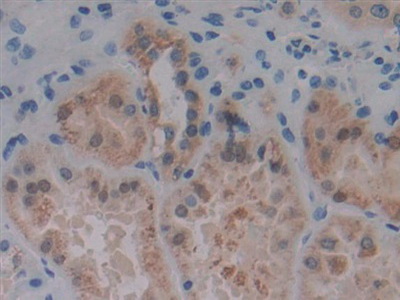 蛋白激酶D1(PKD1)多克隆抗体