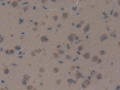 蛋白激酶D1(PKD1)多克隆抗体
