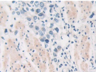 蛋白激酶D2(PKD2)多克隆抗体