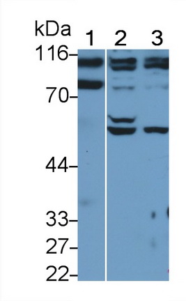 蛋白激酶D2(PKD2)多克隆抗体