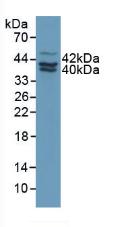 纤溶酶原激活物抑制因子2(PAI2)多克隆抗体