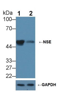 神经元特异性烯醇化酶(NSE)多克隆抗体