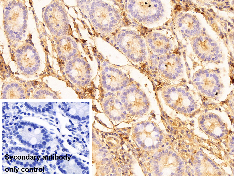 免疫球蛋白A(IgA)多克隆抗體