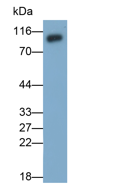 血管細(xì)胞粘附分子1(VCAM1)多克隆抗體