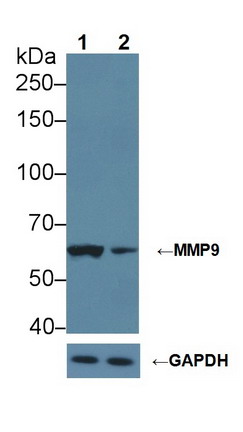 基质金属蛋白酶9(MMP9)多克隆抗体