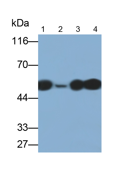 角蛋白7(CK7)多克隆抗体