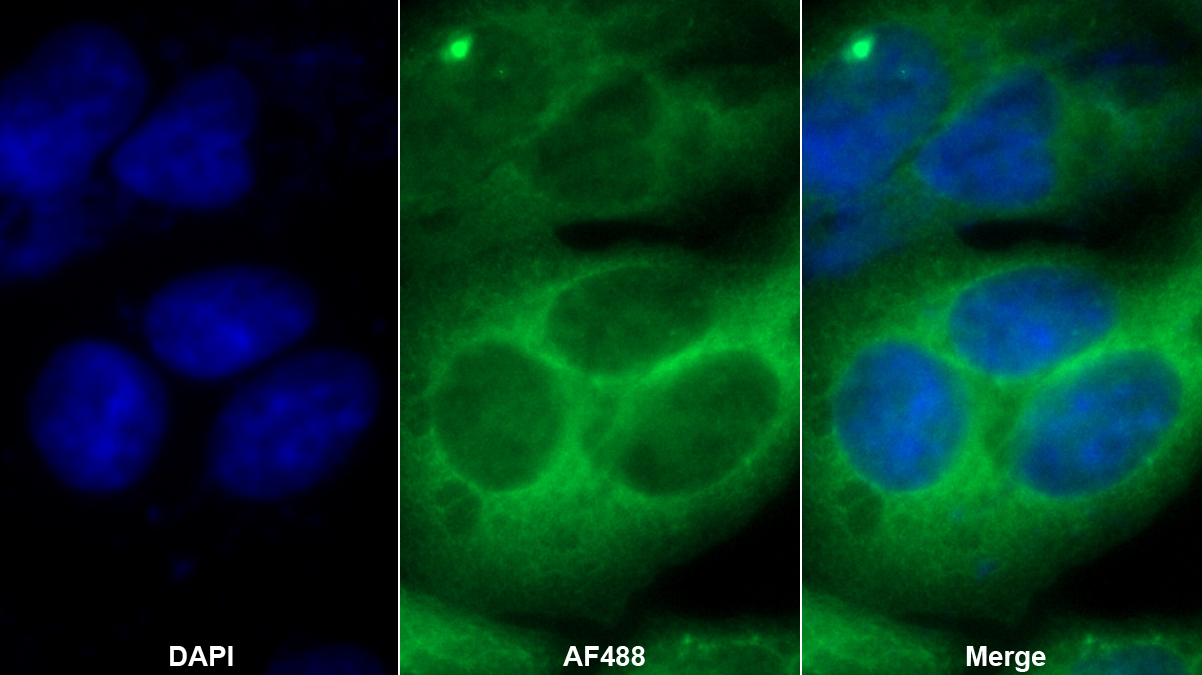 角蛋白7(CK7)多克隆抗體