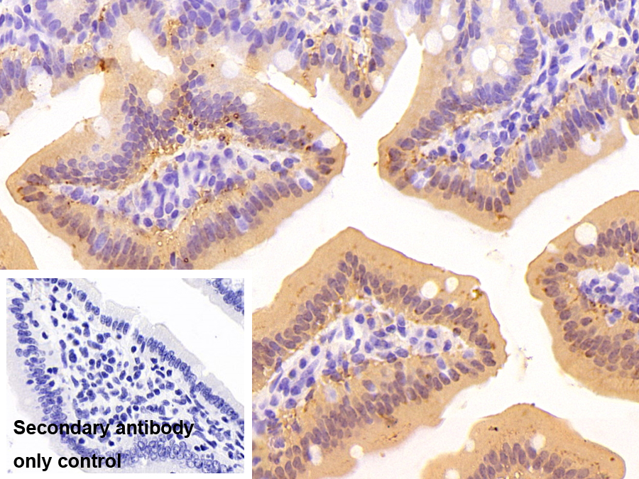 腸型脂肪酸結(jié)合蛋白(FABP2)多克隆抗體