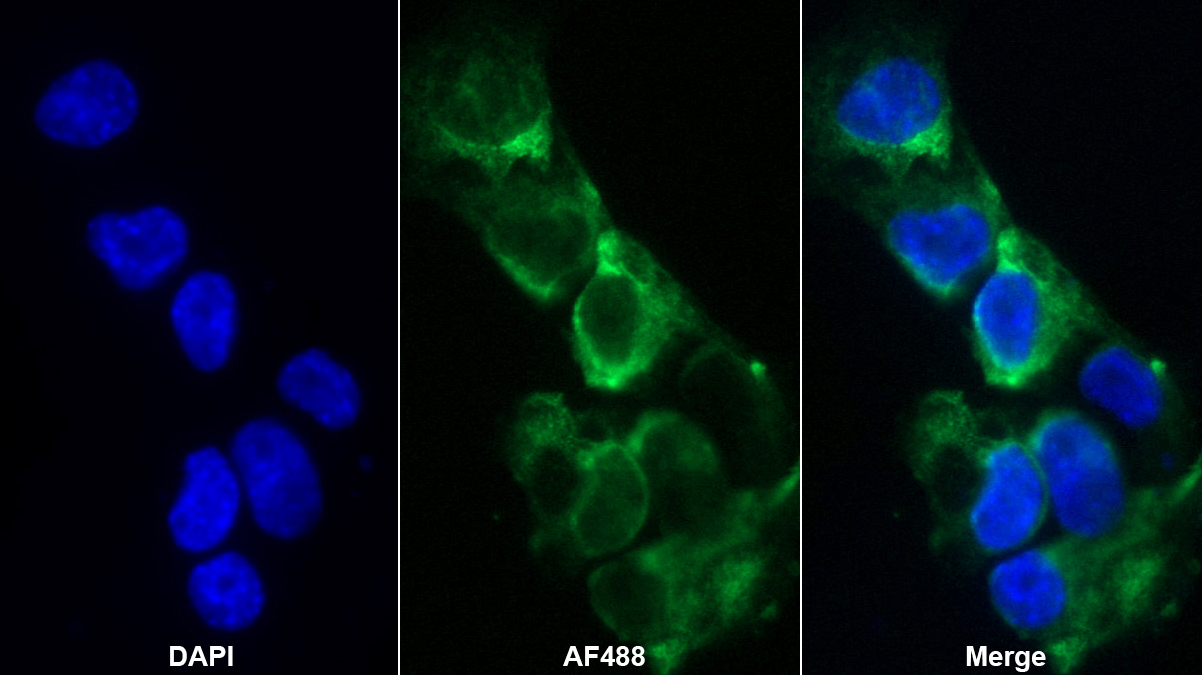 白血病抑制因子受体(LIFR)多克隆抗体