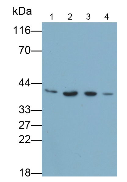 白介素1β(IL1b)多克隆抗体
