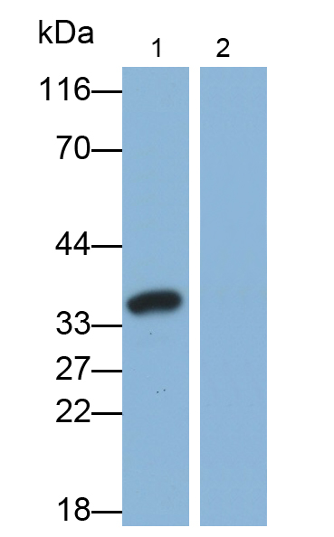 白介素1β(IL1b)多克隆抗体