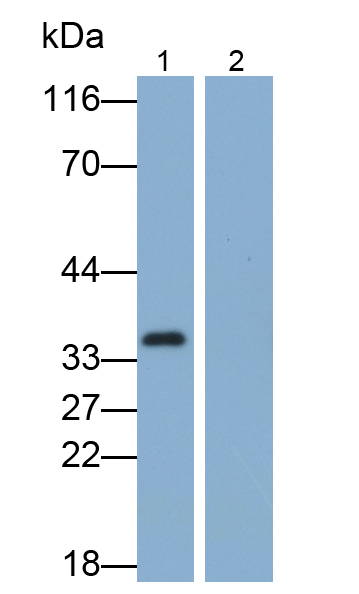 白介素1β(IL1b)多克隆抗体