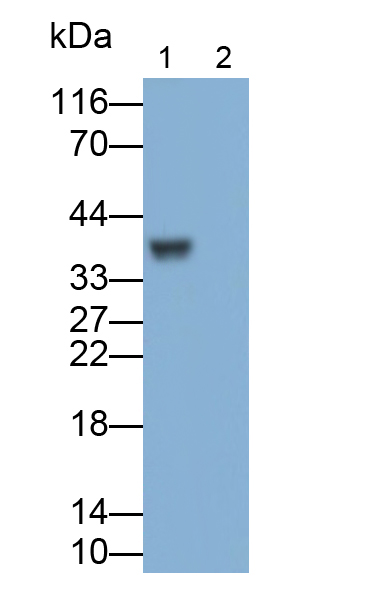 白介素1β(IL1b)多克隆抗體