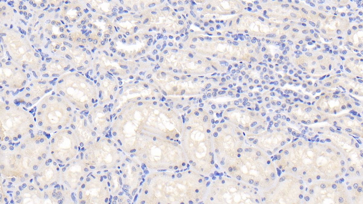 白介素1β(IL1b)多克隆抗體
