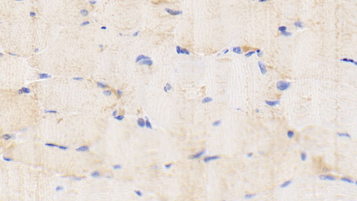 白介素1β(IL1b)多克隆抗體